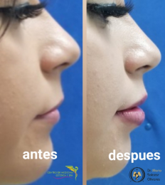 Cirugía estética y Bariatría en Puebla - Dr. Mario Salazar Olivares - Puebla
