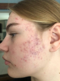 Dermatólogo - Dra. Diana Isabel Morán Maese - Puebla