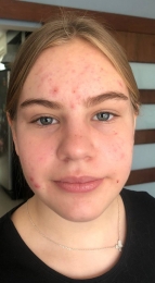 Dermatólogo - Dra. Diana Isabel Morán Maese - Puebla