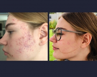 Dermatólogo - Dra. Diana Isabel Morán Maese - Puebla