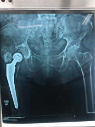 Ortopedista - Dr. Cristian Rivera Reyes - Puebla